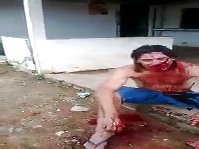 *Brazil* Guy hit by a sickle ON THE FACE and the back, left in a bloody mess