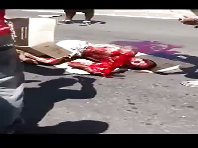 Ran over man who had both legs BROKEN and TWISTED groans in pain (Brazil)