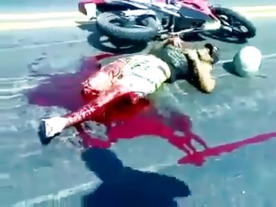 *Brazil* Motorcycle accident leaves man without a leg.