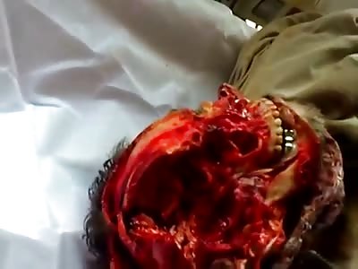 Iraqi terrorist with skull torn apart