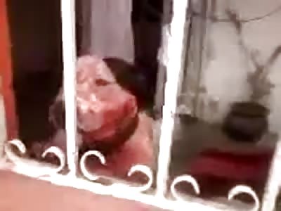 OLD WOMAN ATTAKED BY A PITBULL