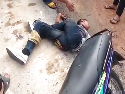 BIKER WITH LEG TWISTED AFTER ACCIDENT