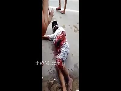 MAN SCREAMING IN TOTAL AGONY AFTER MOTORCYCLE ACCIDENT