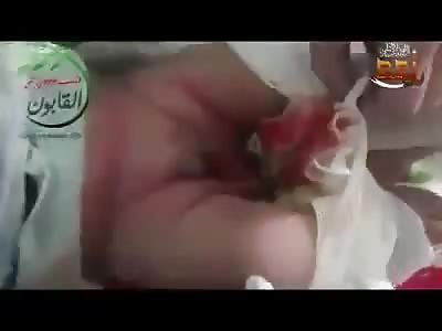 BABY HURT BY BULLET