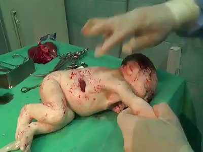 DEAD BABY IN ALEPPO - SYRIA