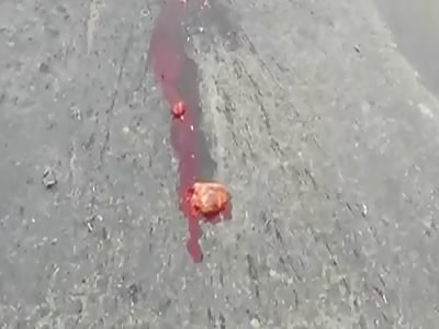 WARNING: EXTREMELY GRAPHIC AND DISTURBING. VIDEO SHOWS SHATTERED BODY, PARTS OF BRAIN EXPOSED, CRUSHED LIVER AND THE HEART AWAY, BEATING ALONE.