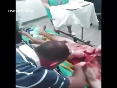 Man With His Chest Sliced Open.