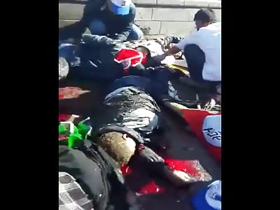 *GRAPHIC* New Footage  Explosion in Ankara