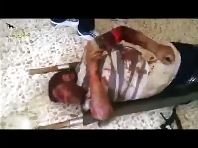 Man leg is blown off during shelling in Syria *Graphic* 