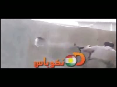 Peshmerga Soldier Shot in the face