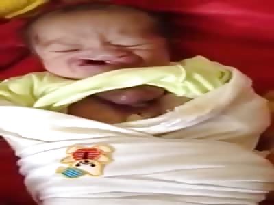Baby Born With Heart Outside His Chest 