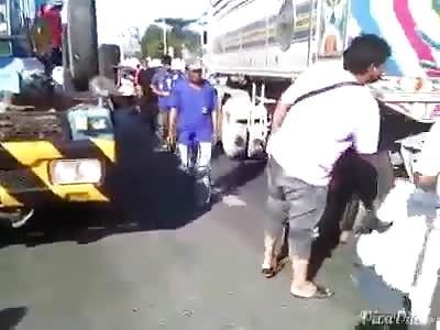 Man's leg Crushed by Truck