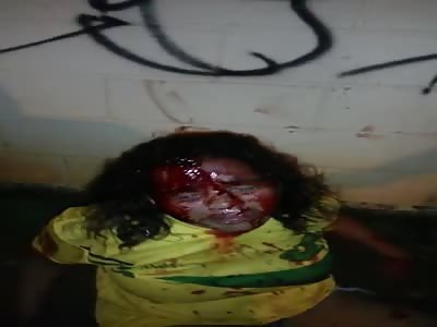 woman stabbed and stoned  by her husband