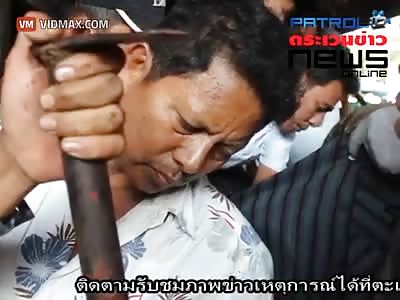 Thai man gets his hand caught in a machine, nearly loses it whole