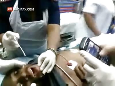 Doctors try and save the life of a man who swallowed his cell phone