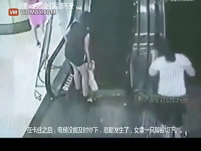 Little Girls Loses Her Foot After Getting Caught In An Escalator.
