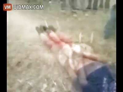 Shocking Video Shows man Have his Leg Cut off with an axe